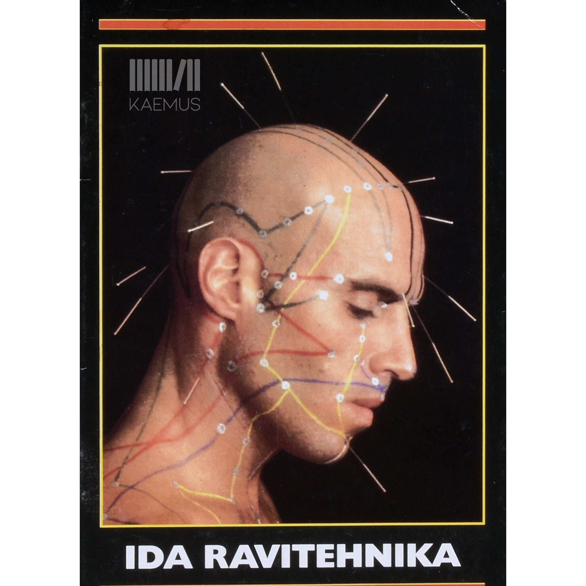 … - Ida ravitehnika